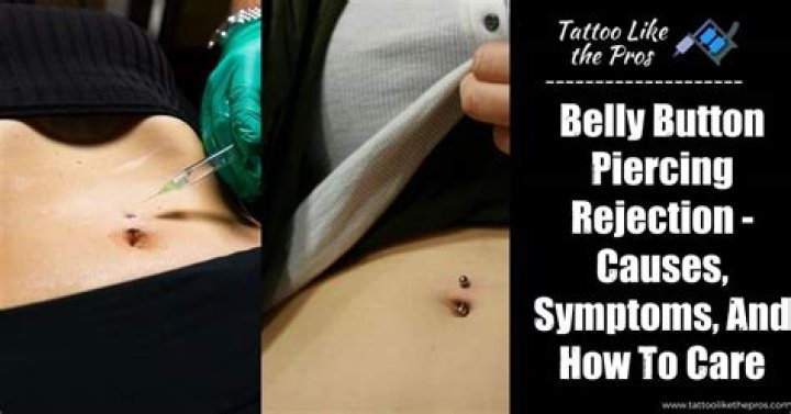 Rejection Belly Piercing: What It Is, Causes, and How to Handle It